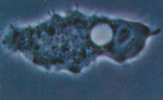 Acanthamoeba_culbertsoni