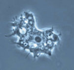 Acanthamoeba_healyi