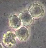 Acanthamoeba_polyphaga