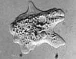 Acanthamoeba_sp_