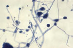 Acremonium_alcalophilum