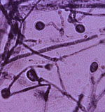 Ajellomyces_dermatitidis