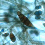 Alternaria_alternata_MR6