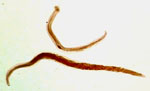 Ancylostoma_ceylanicum