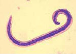 Ancylostoma_duodenale
