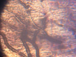 Aphanomyces_astaci_Pc