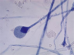 Apophysomyces_trapeziformis_B9324