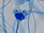 Aspergillus_calidoustus