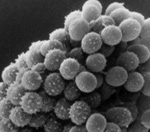 Aspergillus_fumigatus_A1163