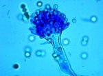 Aspergillus_parasiticus_68_5