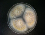 Aspergillus_steynii_IBT_23096