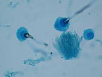 Aspergillus_terreus_45A