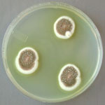 Aspergillus_ustus_3_3904