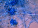 Aspergillus_versicolor_CBS_583_65