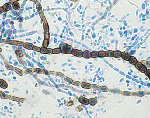 Aureobasidium_pullulans_isolate_Santander