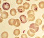 Babesia_sp__WA1