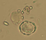 Blastocystis_hominis