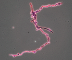 Calcarisporiella_thermophila