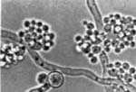 Candida_albicans_ATCC_10231