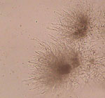 Candida_parapsilosis_CBS6318