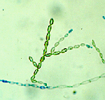 Cladophialophora_bantiana