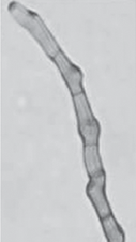 Cochliobolus_victoriae_FI3