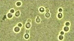 Cryptococcus_albidus_JCM_2334