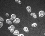 Cryptococcus_gattii_VGIII_ATCC32609