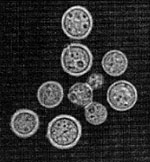 Cryptococcus_gattii_VGIII_CA1280