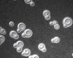 Cryptococcus_gattii_VGI_WM276