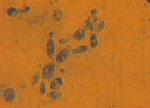 Cryptococcus_laurentii_RY1
