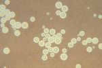Cryptococcus_neoformans_var__grubii_CM50