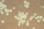 Cryptococcus_neoformans_var__grubii_D17_1
