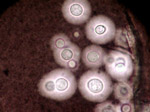 Cryptococcus_neoformans_var__neoformans_JEC20