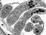 Cryptosporidium_hominis_IbA9G3_isolate_14_00278