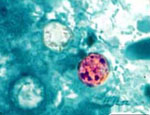 Cyclospora_cayetanensis_CDC_HCGM01_97