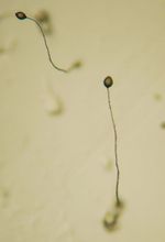 Dictyostelium_discoideum_AX4