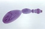 Echinococcus_granulosus