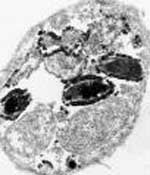 Encephalitozoon_intestinalis