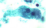 Entamoeba_dispar_SAW760