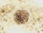 Entamoeba_histolytica_HM1_IMSS_clone_6