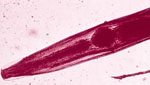 Enterobius_vermicularis
