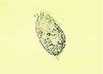 Euplotes_octocarinatus