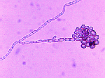 Exophiala_dermatitidis_NIH_UT8656