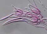 Fusarium_equiseti_CS3069