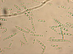 Fusarium_oxysporum_CS5870