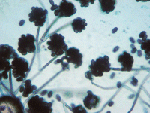 Fusarium_sporotrichioides