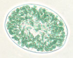 Glaucocystis_nostochinearum