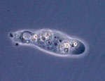Hartmannella_vermiformis