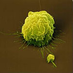 Homo_sapiens_Cancer_Cells